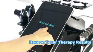 Máy trị liệu Hazeon Tecar RL-W20 – Thiết bị vật lý trị liệu & phục hồi chức năng tiên tiến 448kHz